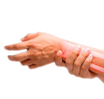 Rehabilitación Reumatológica