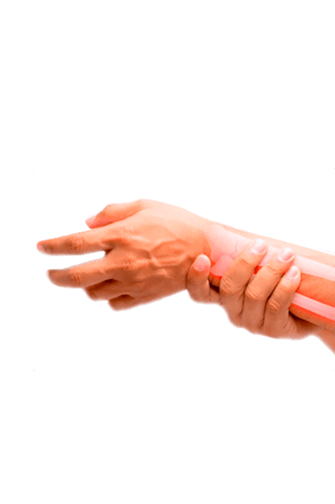 Rehabilitación Reumatológica