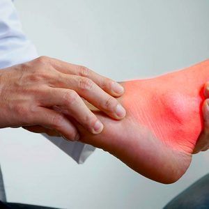 Rehabilitación Reumatológica