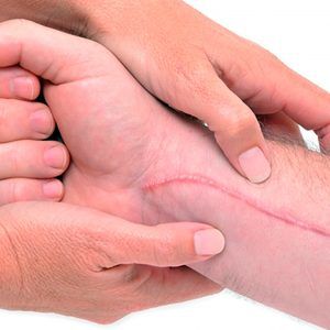 Rehabilitación en Cirugía Plástica